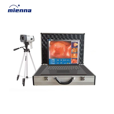 Stafrænt rafrænt colposcope fyrir skurðlækningar